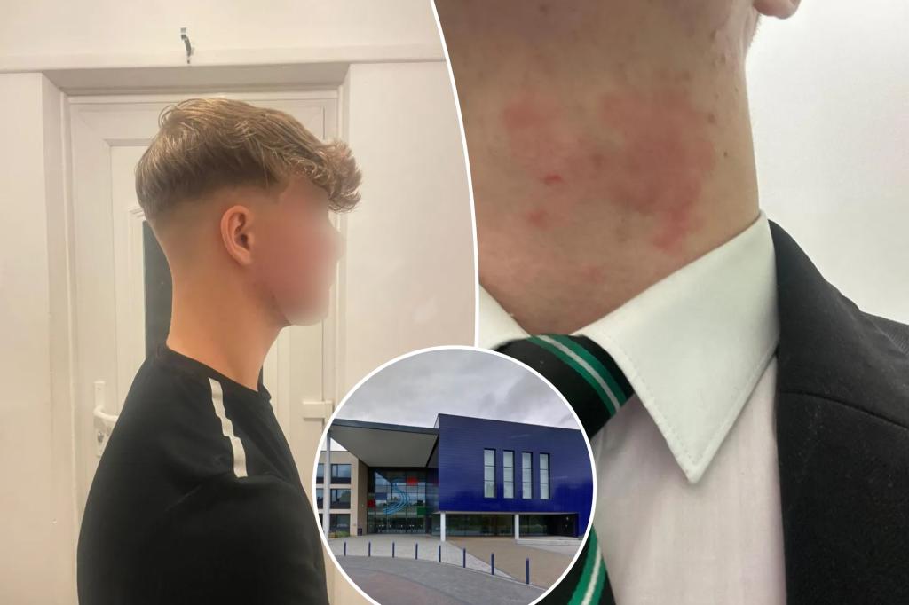 Student punished for 'extreme' haircut intended to help with his eczema